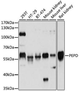 Western blot - PEPD antibody (A5416)