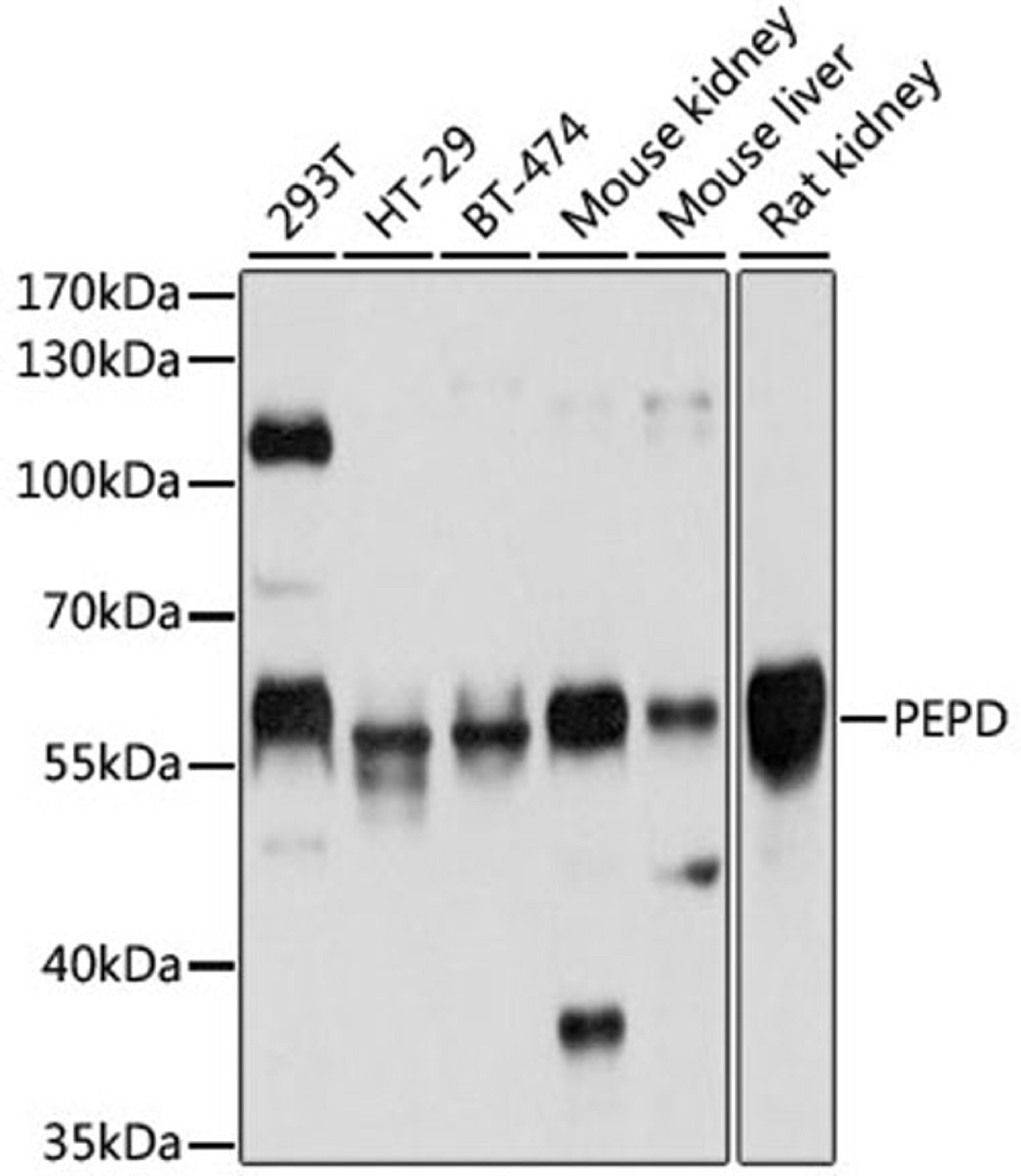 Western blot - PEPD antibody (A5416)