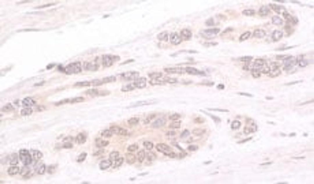 Detection of human ATRIP by immunohistochemistry.