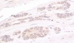 Detection of human ATRIP by immunohistochemistry.