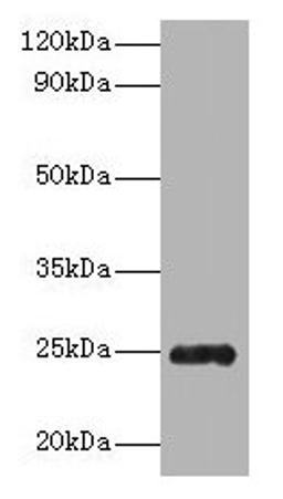Western blot. All lanes: Trypsin antibody at 2µg/ml + Recombinant Pig Trypsin protein 1µg. Secondary. Goat polyclonal to rabbit IgG at 1/10000 dilution. Predicted band size: 25 kDa. Observed band size: 25 kDa