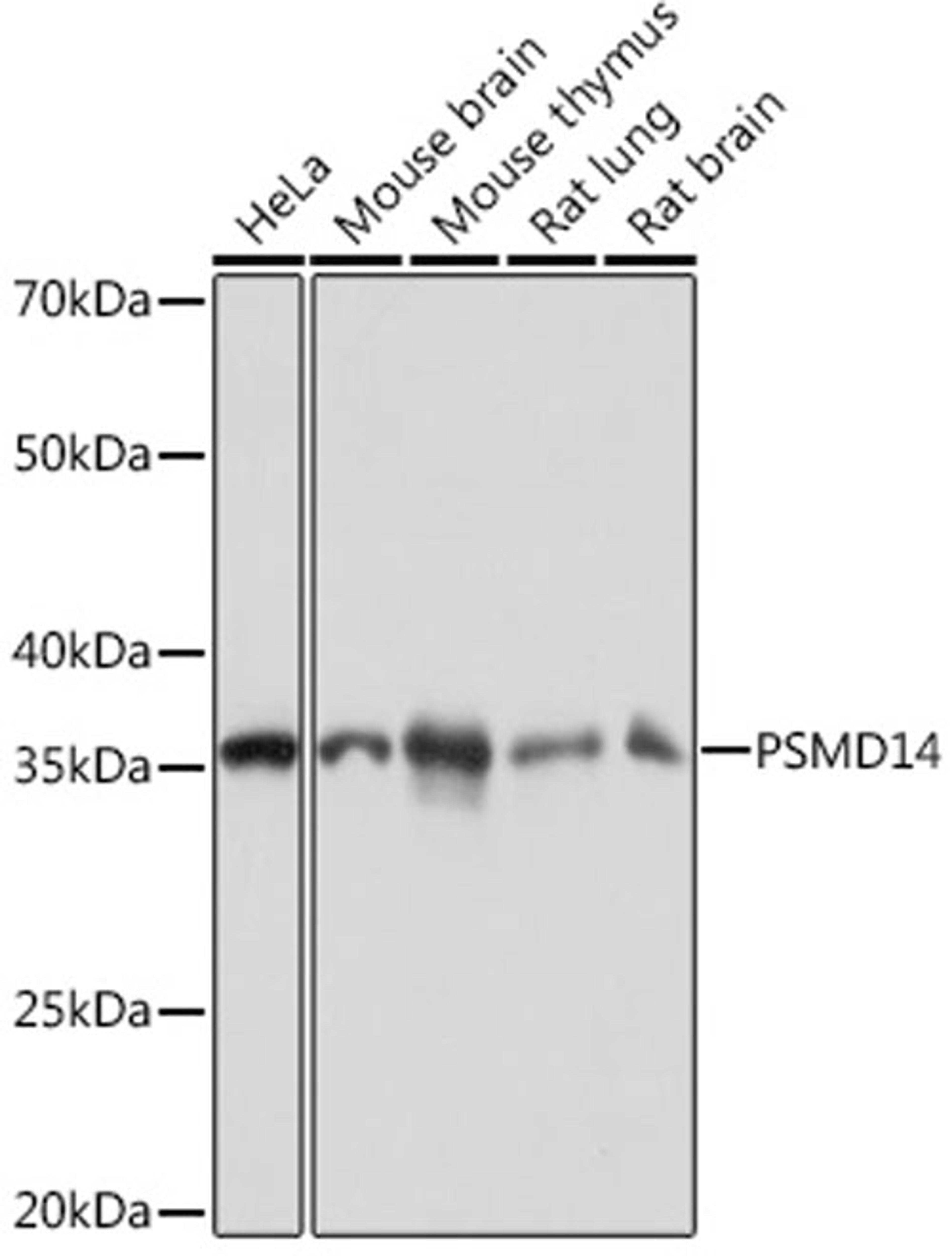 Western blot - PSMD14 Rabbit mAb (A9608)