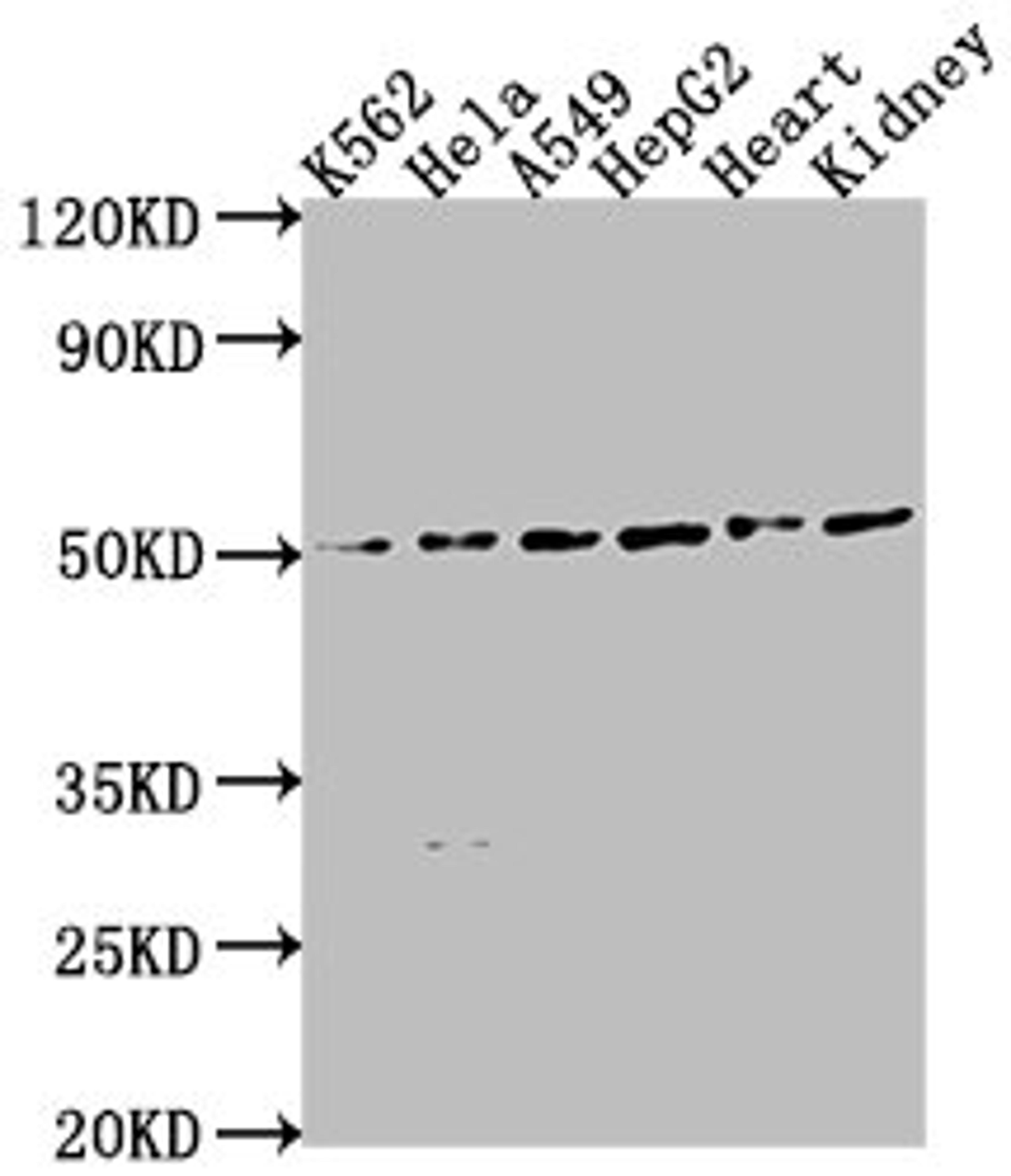 Western Blot. Positive WB detected in: K562 whole cell lysate, HeLa whole cell lysate, A549 whole cell lysate, HepG2 whole cell lysate, Mouse heart tissue, Mouse kidney tissue. All lanes: ENPP7 antibody at 1:2000. Secondary. Goat polyclonal to rabbit IgG at 1/50000 dilution. Predicted band size: 52 kDa. Observed band size: 52 kDa.
