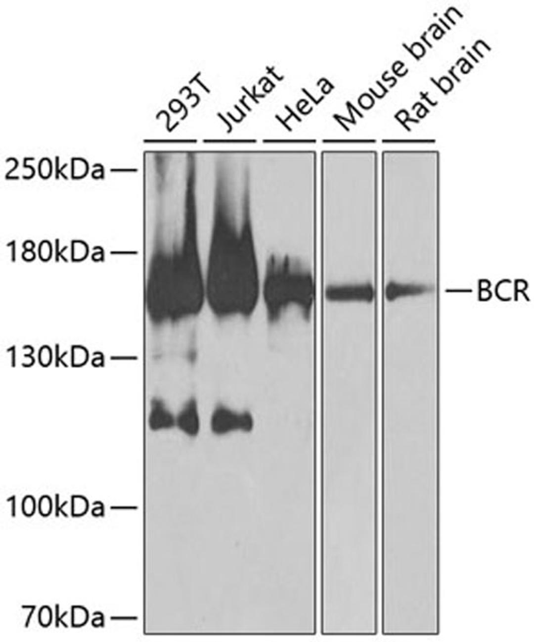 Western blot - BCR antibody (A0068)