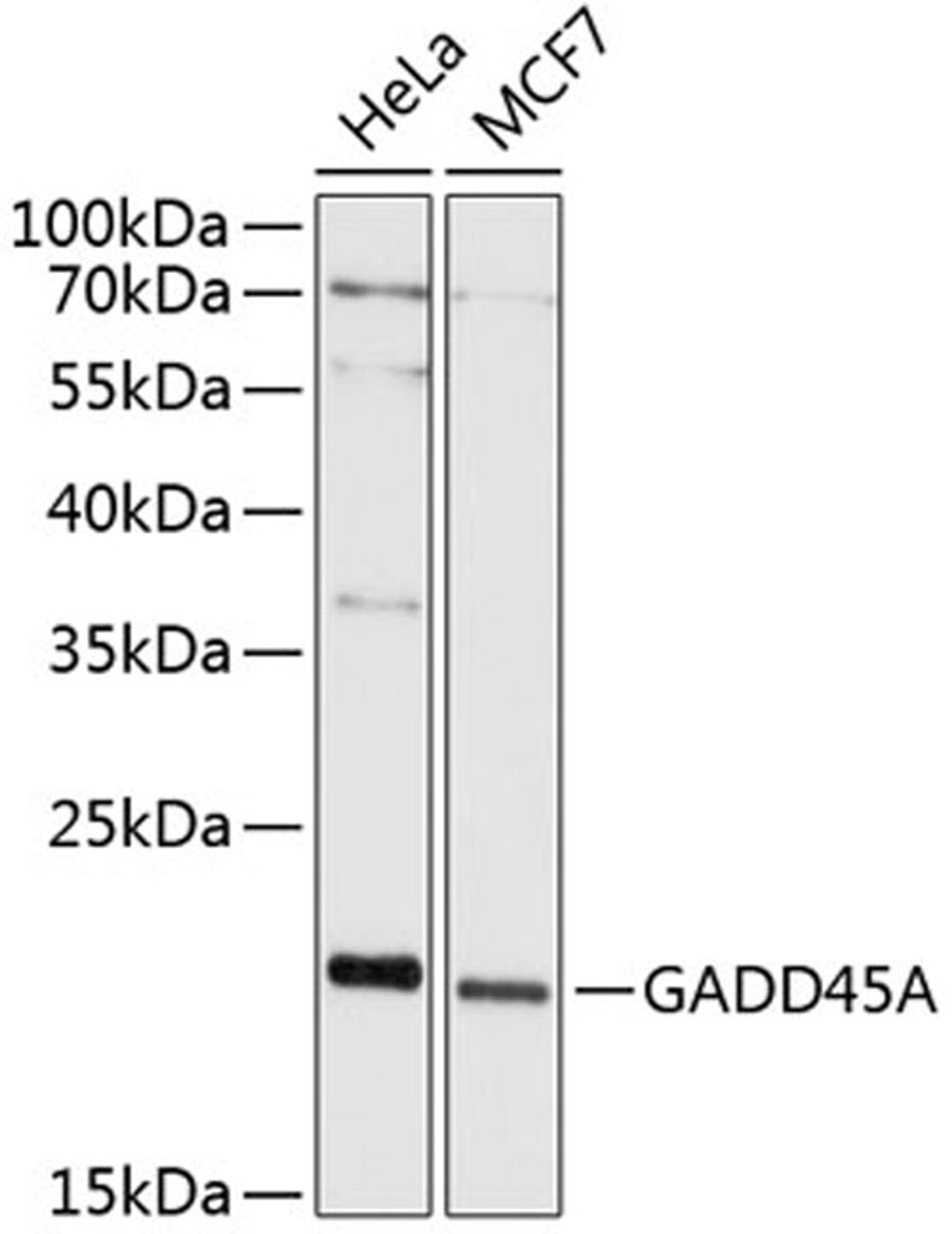 Western blot - GADD45A antibody (A11768)