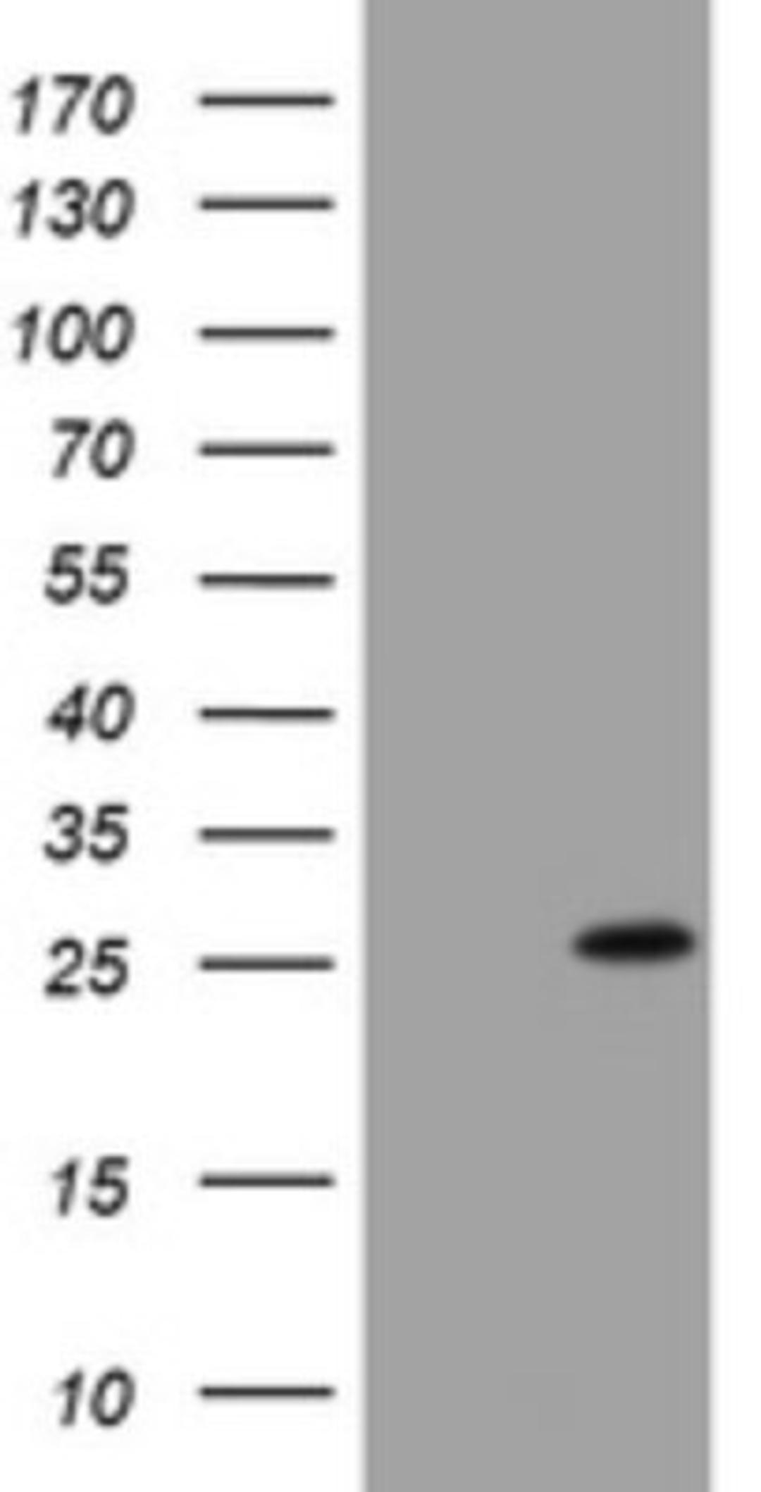 Western Blot: BNIP1 Antibody (2B3) [NBP2-46580] - Analysis of HEK293T cells were transfected with the pCMV6-ENTRY control (Left lane) or pCMV6-ENTRY BNIP1.