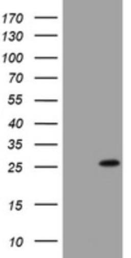 Western Blot: BNIP1 Antibody (2B3) [NBP2-46580] - Analysis of HEK293T cells were transfected with the pCMV6-ENTRY control (Left lane) or pCMV6-ENTRY BNIP1.