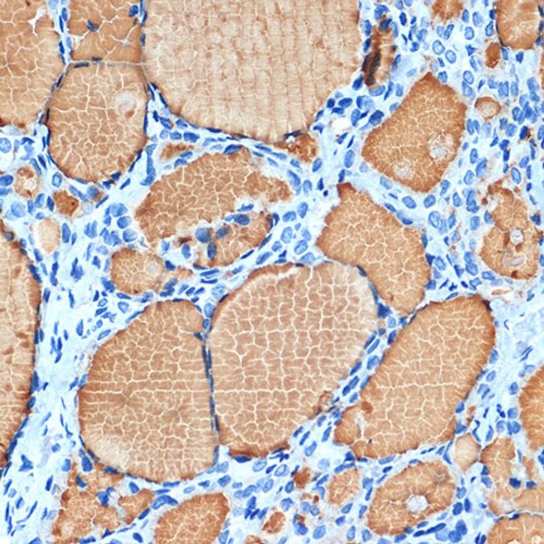 Immunohistochemistry - Thyroglobulin Rabbit mAb (A3407)