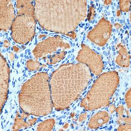 Immunohistochemistry - Thyroglobulin Rabbit mAb (A3407)