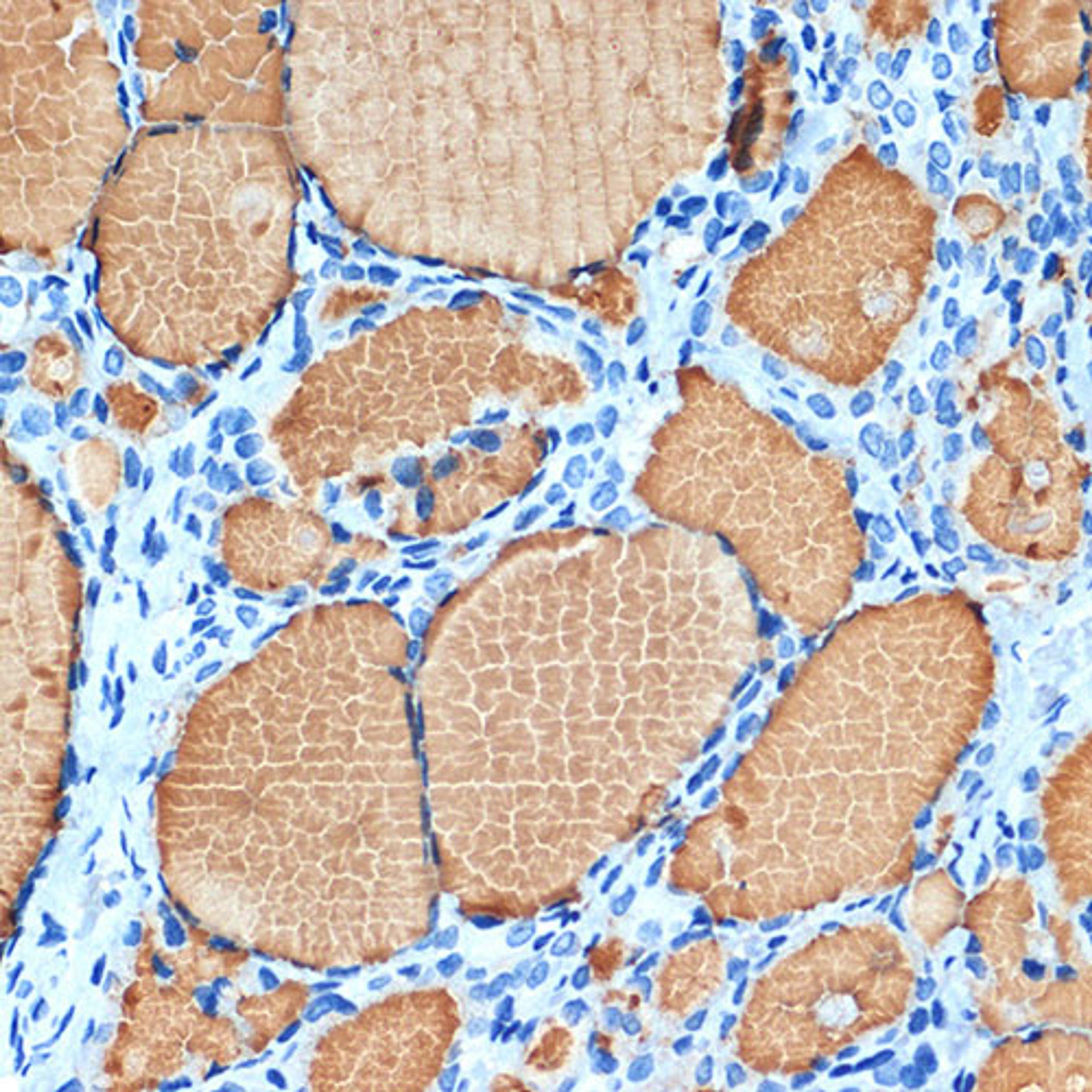 Immunohistochemistry - Thyroglobulin Rabbit mAb (A3407)