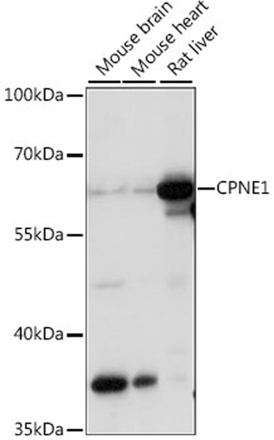 Western blot - CPNE1 antibody (A15749)