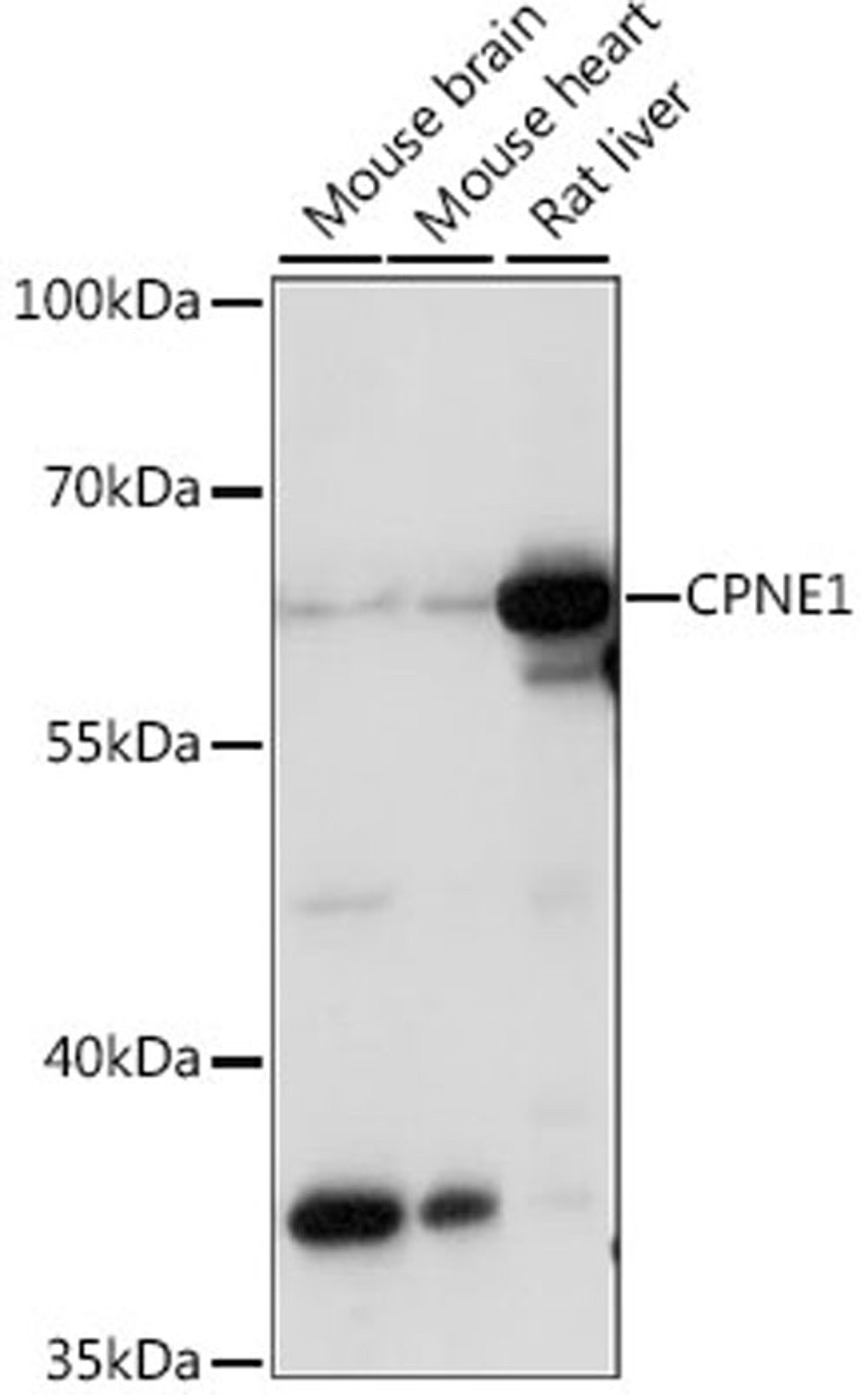 Western blot - CPNE1 antibody (A15749)