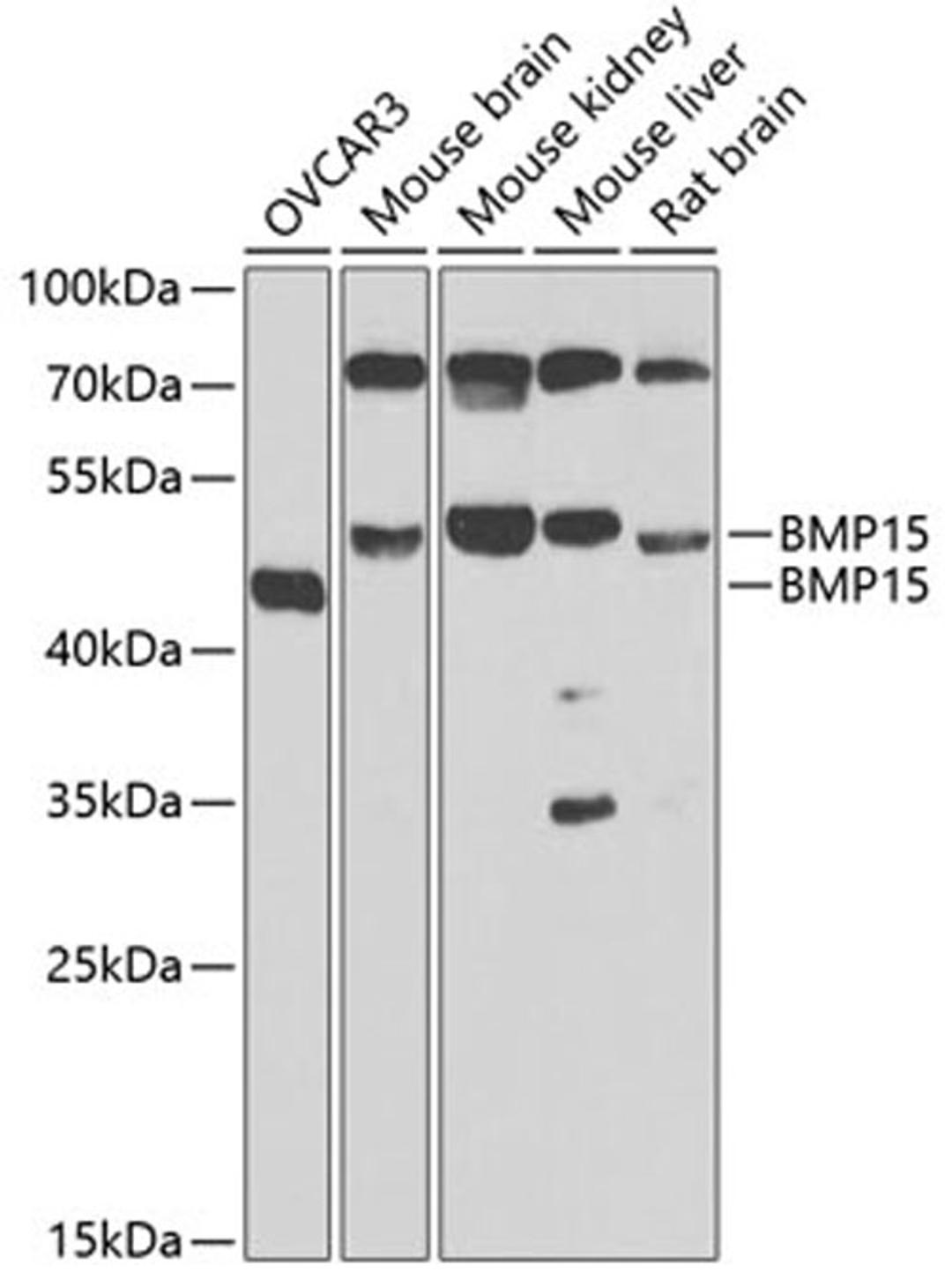 Western blot - BMP15 antibody (A7321)