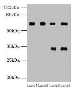 Western blot. All lanes: PGM1 antibody at 6µg/ml. Lane 1: U251 whole cell lysate. Lane 2: U937 whole cell lysate. Lane 3: Jurkat whole cell lysate. Lane 4: Hela whole cell lysate. Secondary. Goat polyclonal to rabbit IgG at 1/10000 dilution. Predicted band size: 62, 64, 41 kDa. Observed band size: 62 kDa