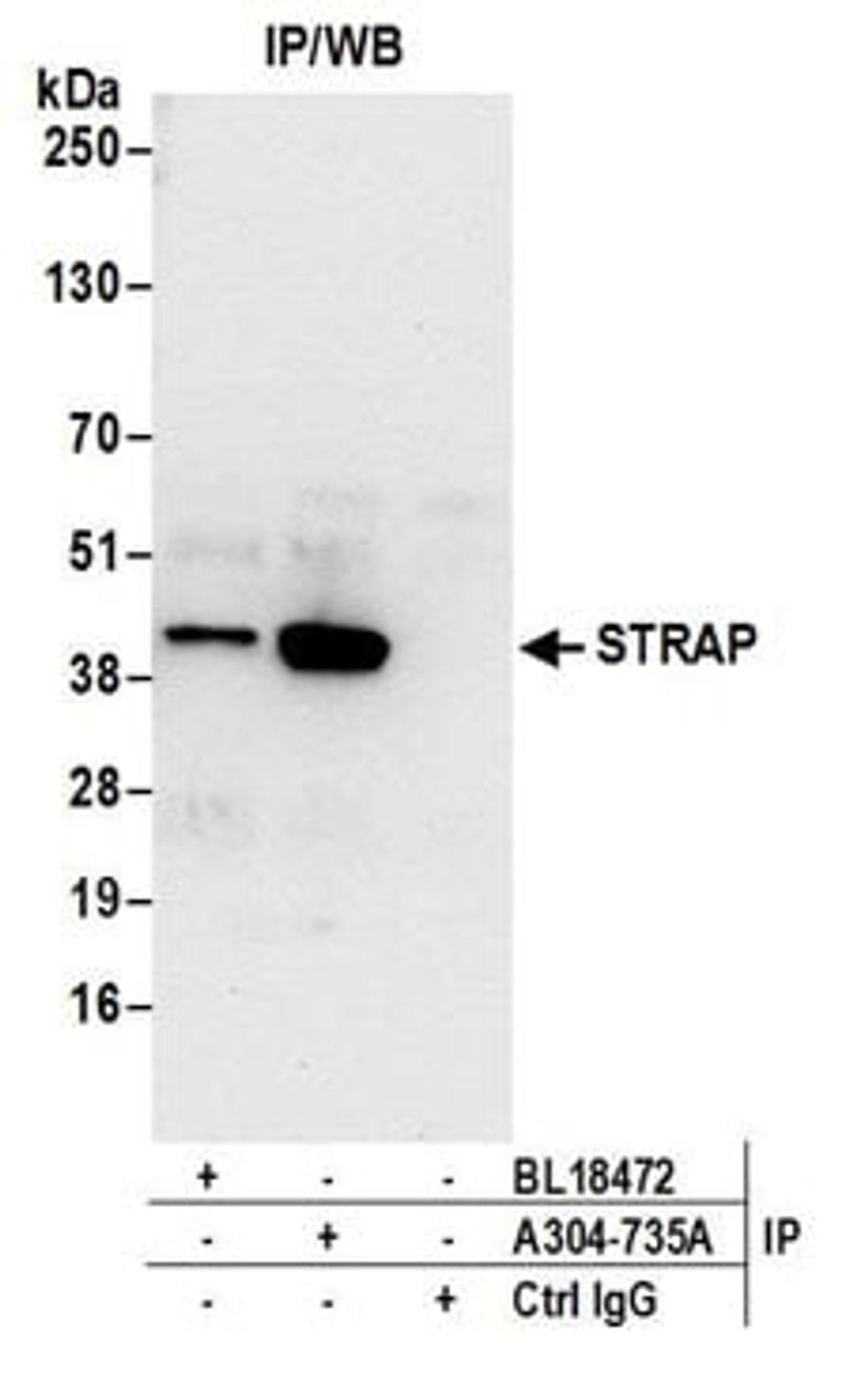 Detection of human STRAP by western blot of immunoprecipitates.