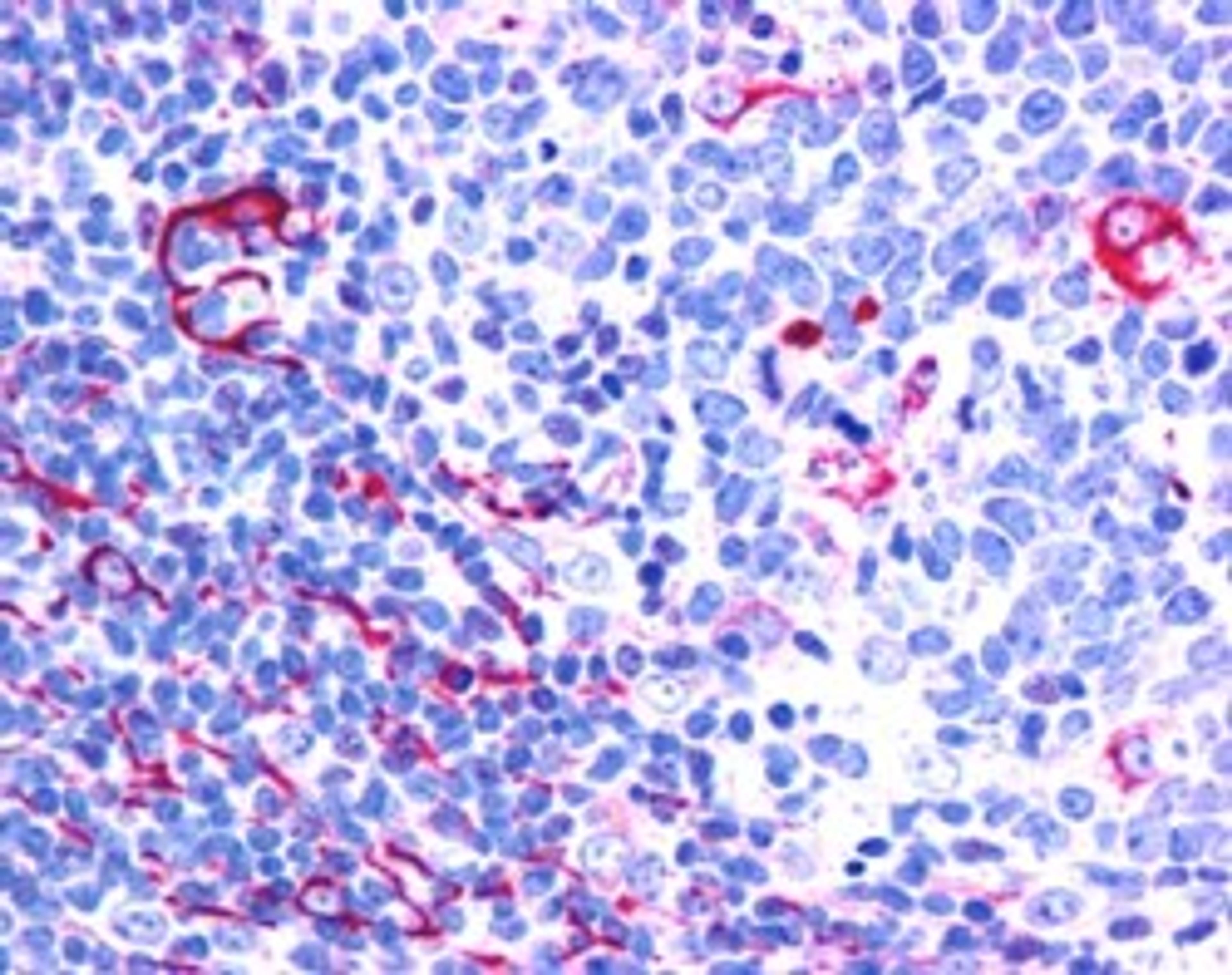 45-947 (2.5ug/ml) staining of paraffin embedded Human Tonsil. Steamed antigen retrieval with citrate buffer pH 6, AP-staining.