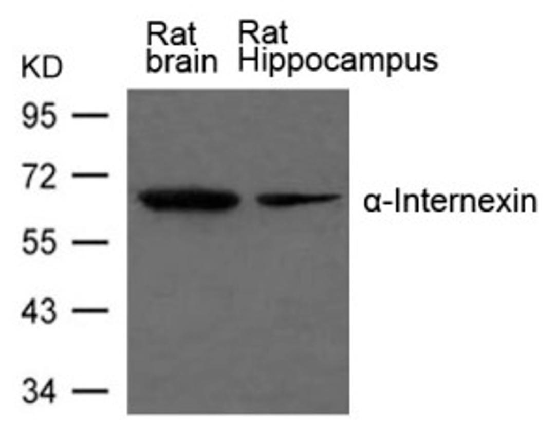 Western blot analysis of extract from Rat brain and Rat hippocampus Tissue using α-Internexin Antibody.