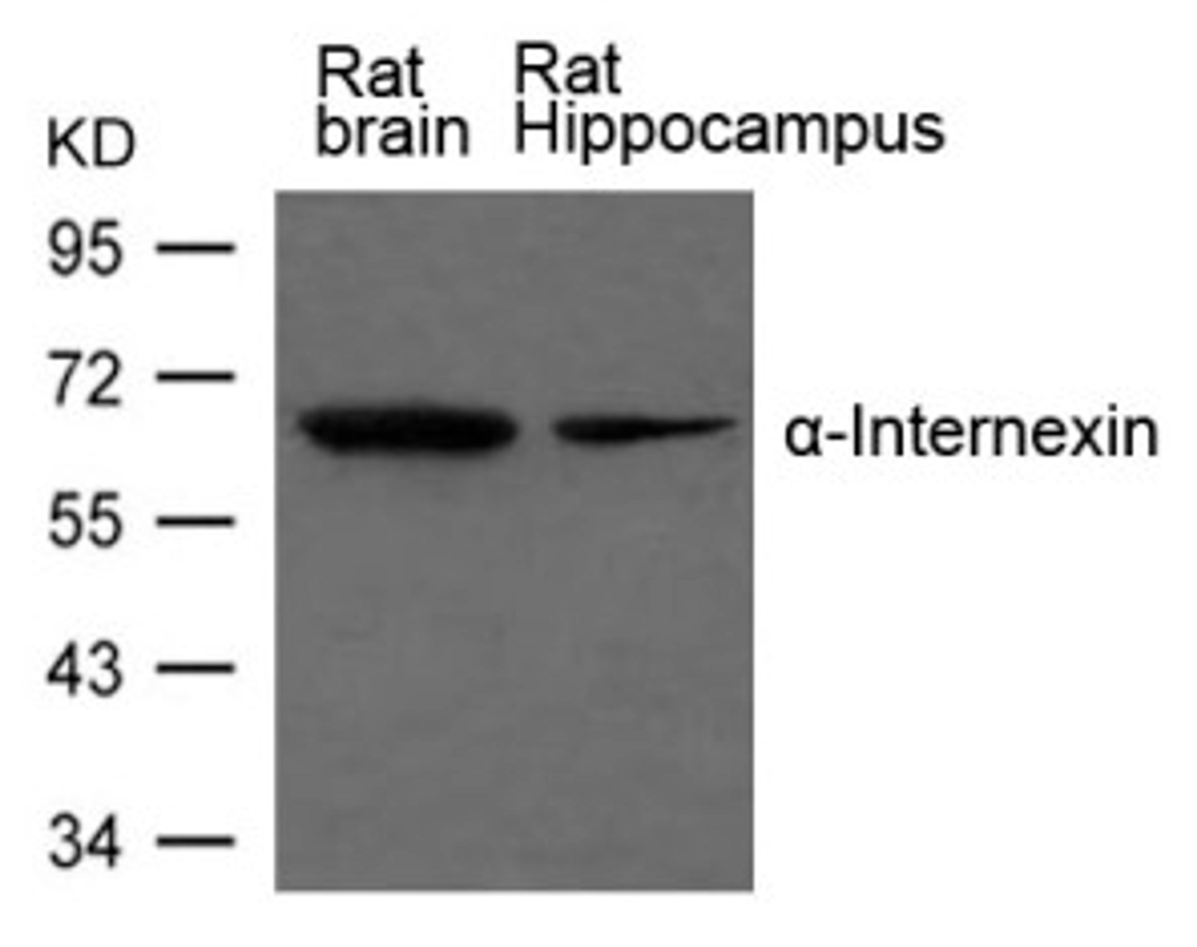 Western blot analysis of extract from Rat brain and Rat hippocampus Tissue using α-Internexin Antibody.