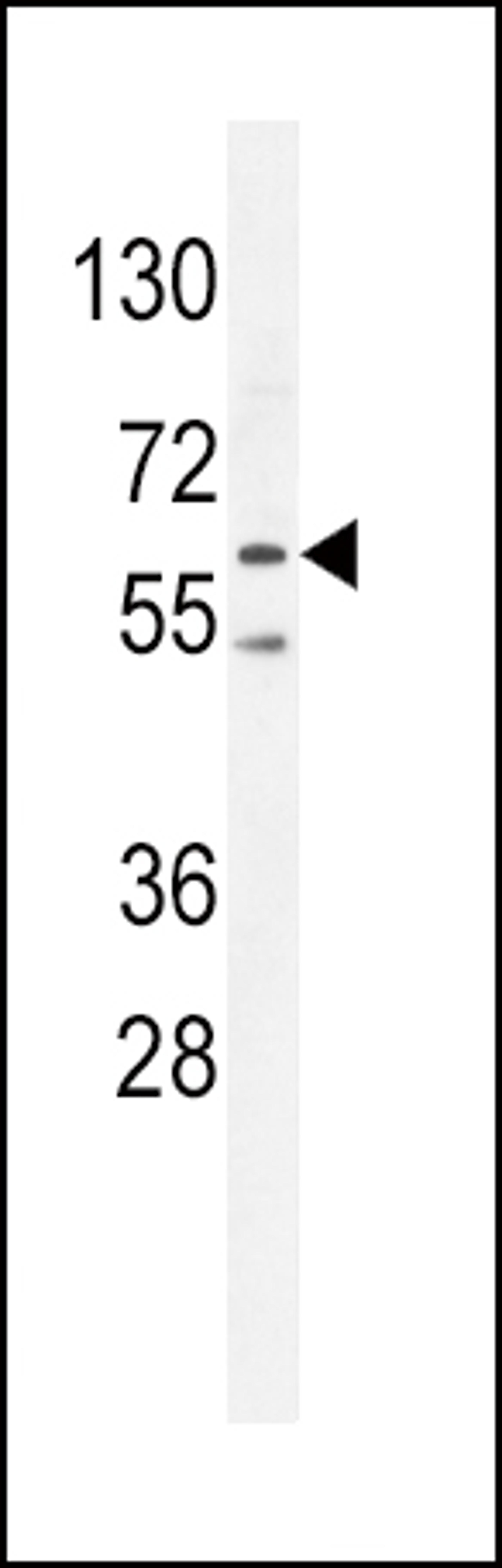 Western blot analysis in K562 cell line lysates (35ug/lane).This demonstrdetected the PRKAA2 protein (arrow).