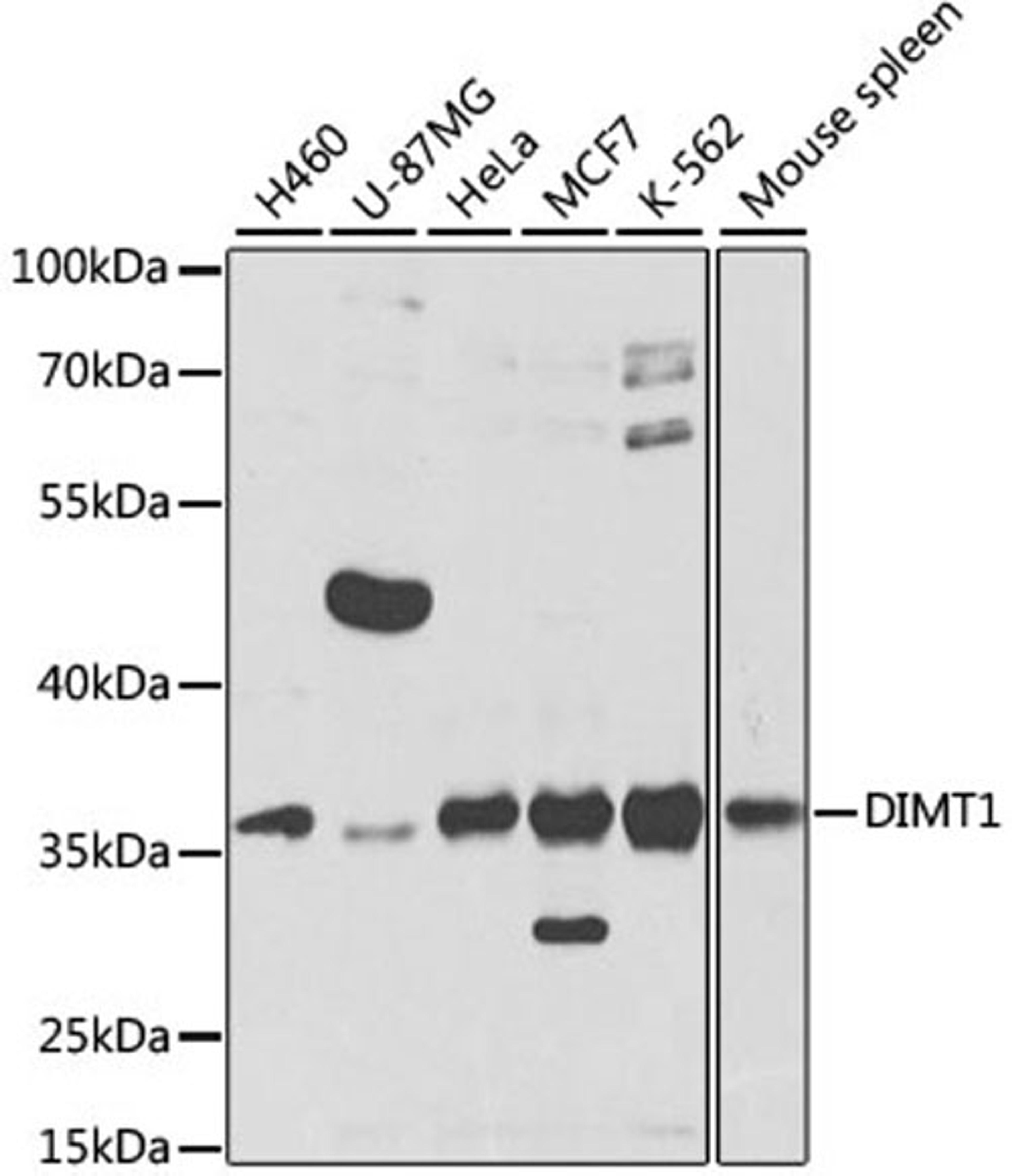 Western blot - DIMT1 antibody (A7589)