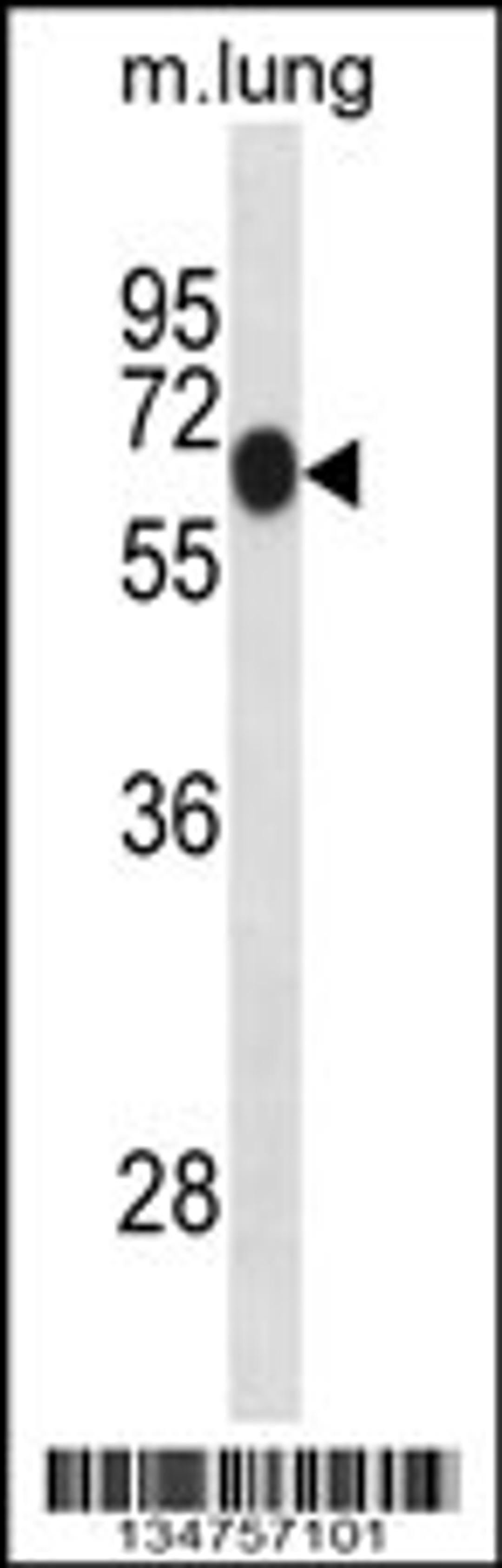 Western blot analysis in mouse lung tissue lysates (35ug/lane).