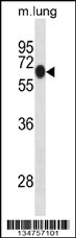 Western blot analysis in mouse lung tissue lysates (35ug/lane).