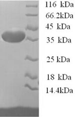 (Tris-Glycine gel) Discontinuous SDS-PAGE (reduced) with 5% enrichment gel and 15% separation gel.