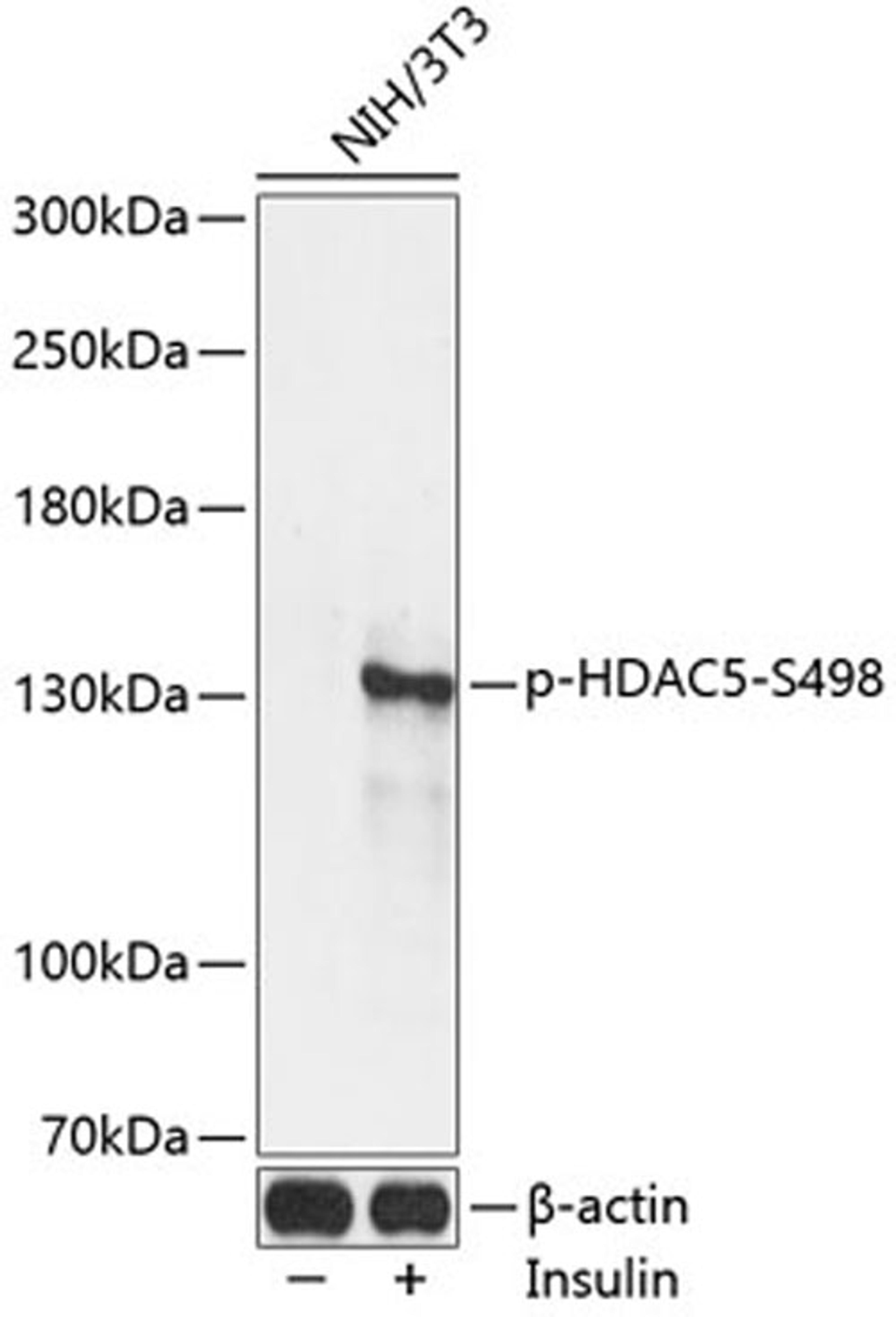 Western blot - Phospho-HDAC5-S498 antibody (AP0202)