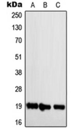 Western blot analysis of Jurkat (Lane 1), Raw264.7 (Lane 2), H9C2 (Lane 3) whole cell lysates using NBL1 antibody