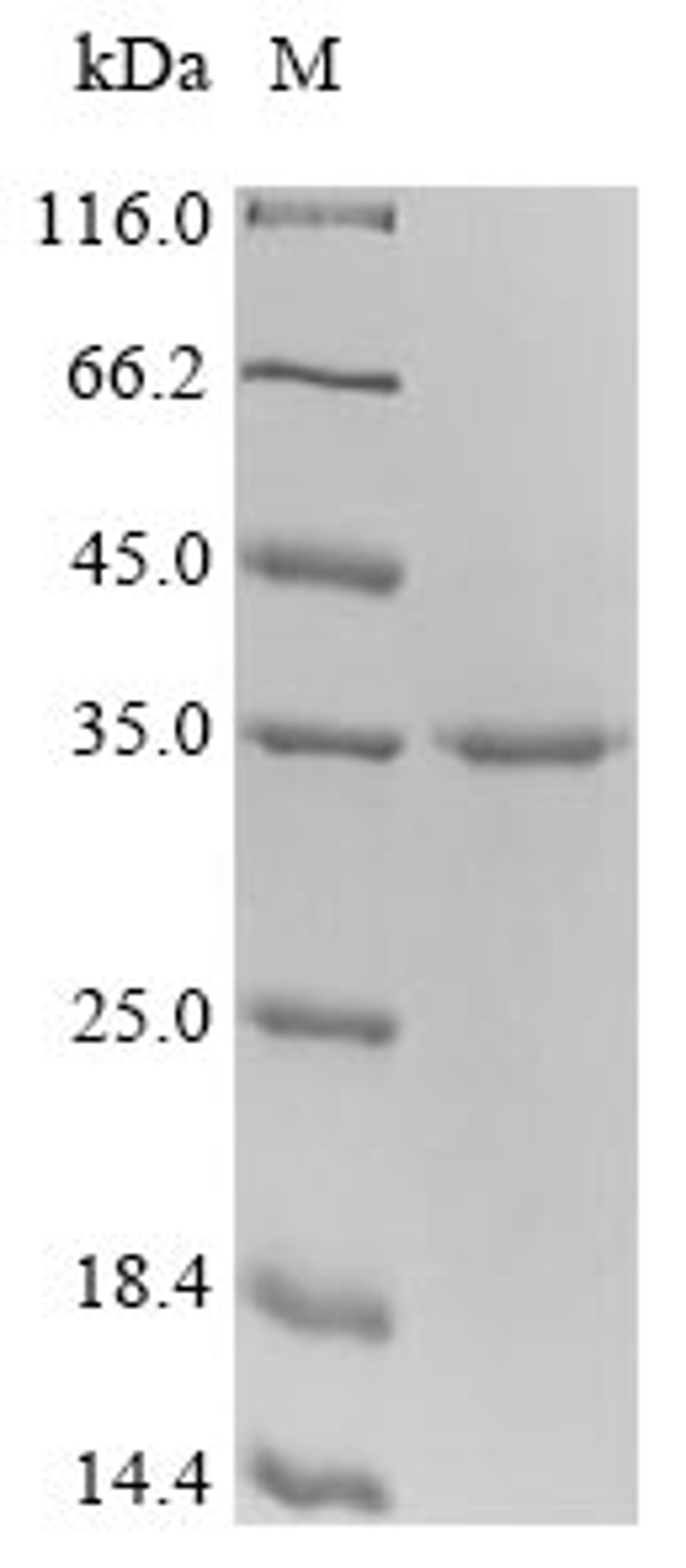 (Tris-Glycine gel) Discontinuous SDS-PAGE (reduced) with 5% enrichment gel and 15% separation gel.