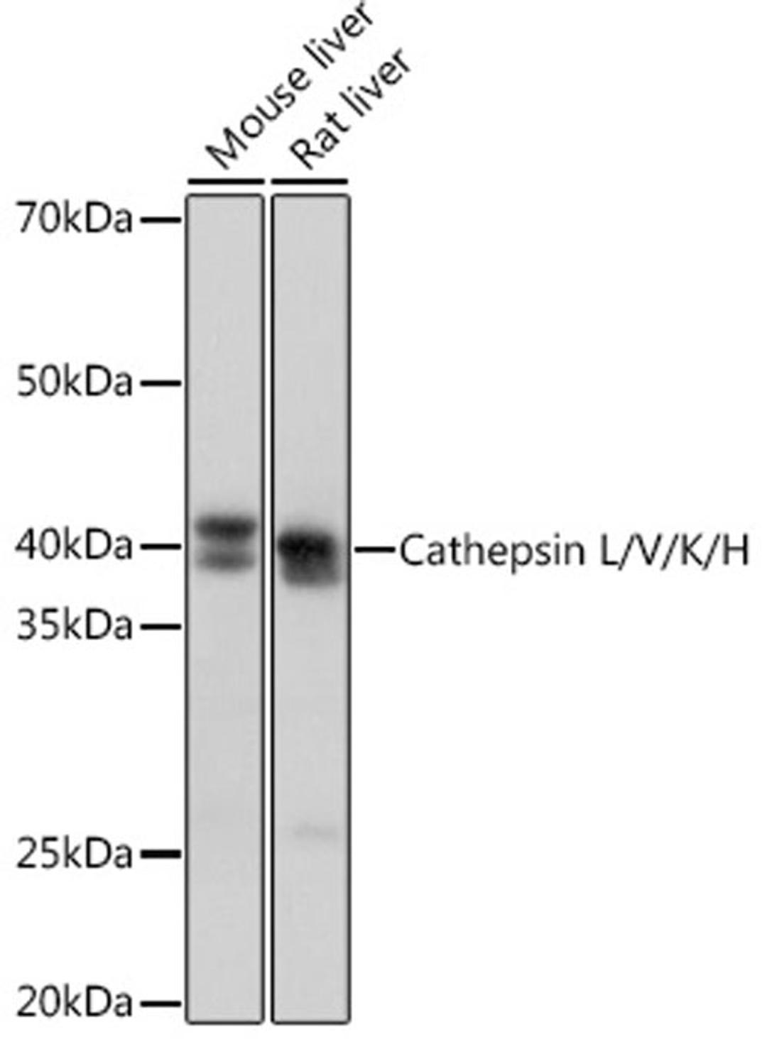 Western blot - Cathepsin L/V/K/H Rabbit mAb (A4986)