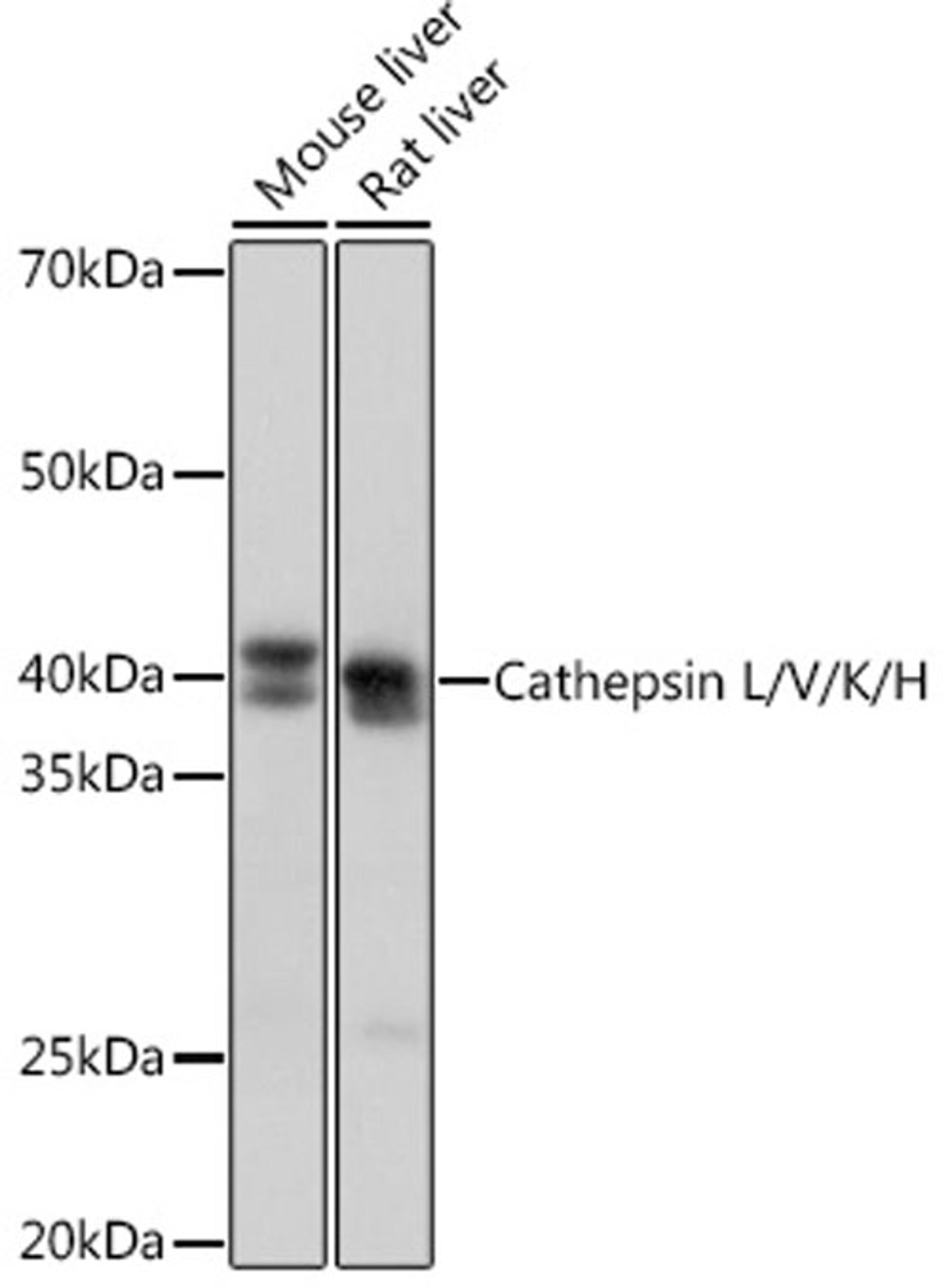 Western blot - Cathepsin L/V/K/H Rabbit mAb (A4986)