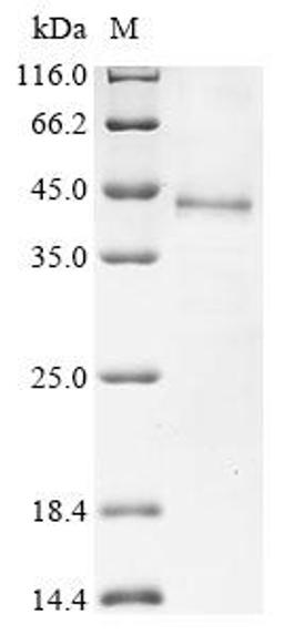 (Tris-Glycine gel) Discontinuous SDS-PAGE (reduced) with 5% enrichment gel and 15% separation gel.