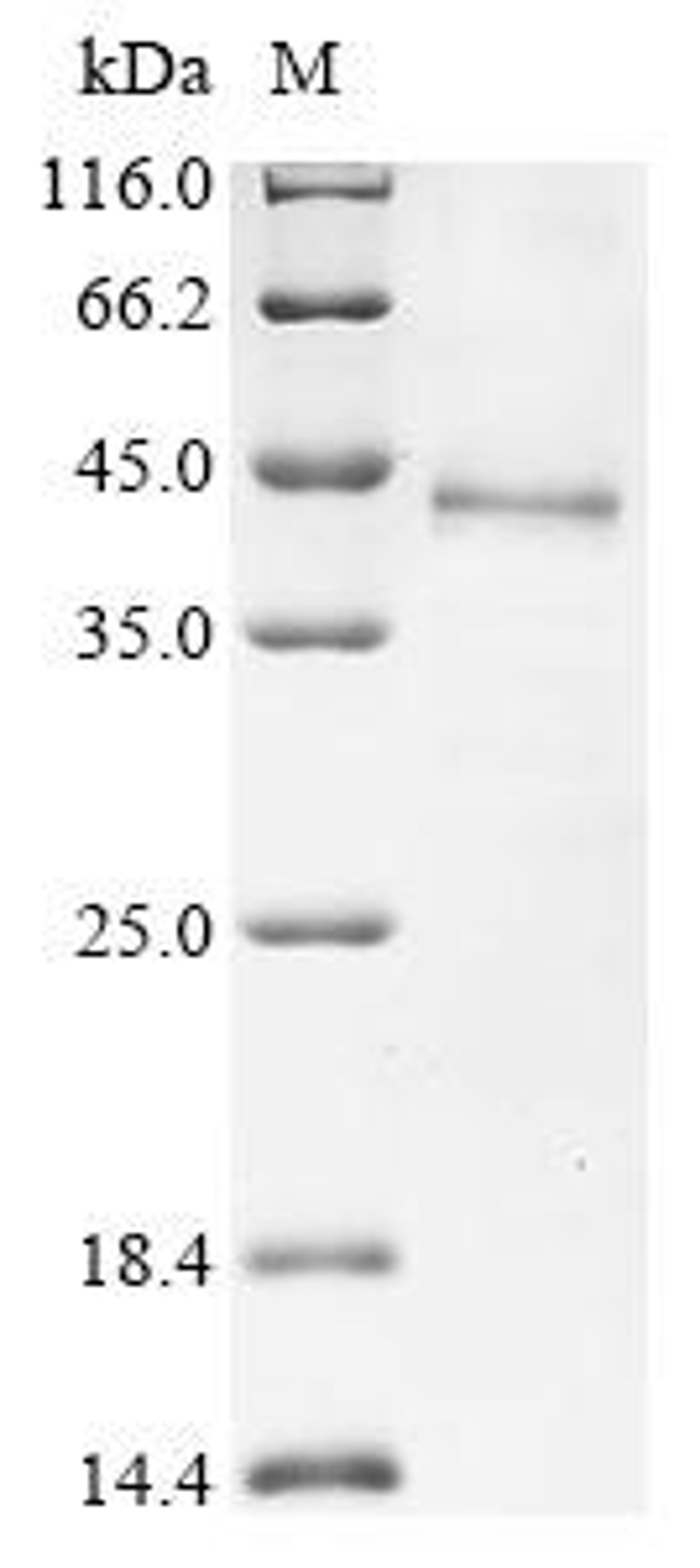 (Tris-Glycine gel) Discontinuous SDS-PAGE (reduced) with 5% enrichment gel and 15% separation gel.