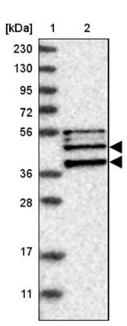 Western Blot: SH3GL2 Antibody [NBP1-85521] - Lane 1: Marker [kDa] 230, 130, 95, 72, 56, 36, 28, 17, 11<br/>Lane 2: Human cell line RT-4