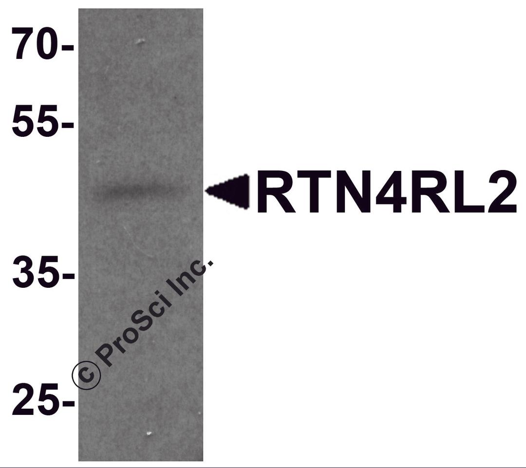 Western blot analysis of RTN4RL2 in rat brain tissue lysate with RTN4RL2 antibody at 1 &#956;g/mL.