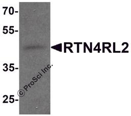 Western blot analysis of RTN4RL2 in rat brain tissue lysate with RTN4RL2 antibody at 1 μg/mL.