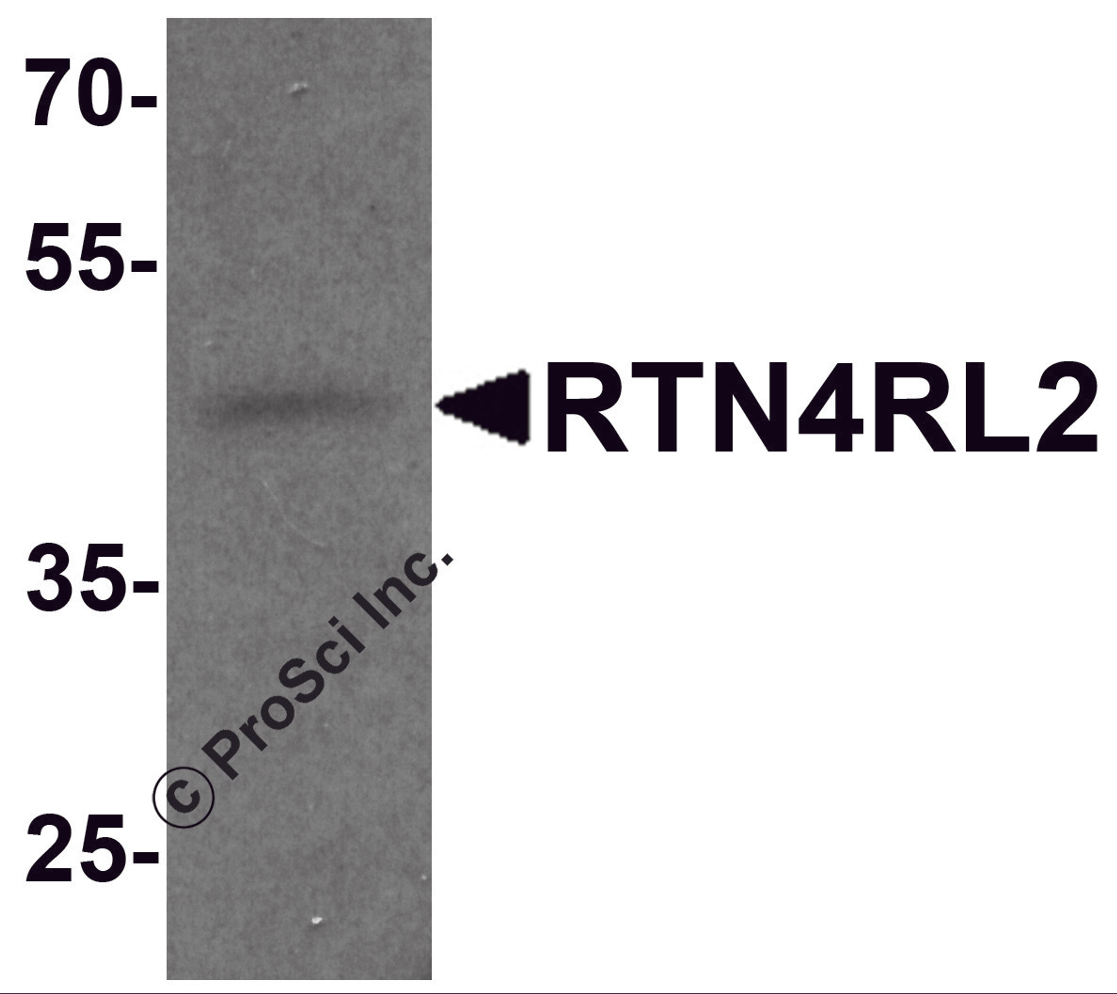 Western blot analysis of RTN4RL2 in rat brain tissue lysate with RTN4RL2 antibody at 1 μg/mL.
