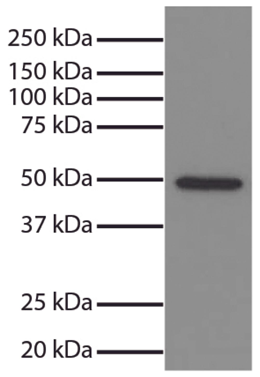 Total cell lysates from Jurkat cells were resolved by electrophoresis, transferred to PVDF membrane, and probed with Mouse Anti-GSK-3?-UNLB (Cat. No. 99-742). Proteins were visualized using Goat Anti-Mouse IgG, Human ads-HRP secondary antibody and chemilu