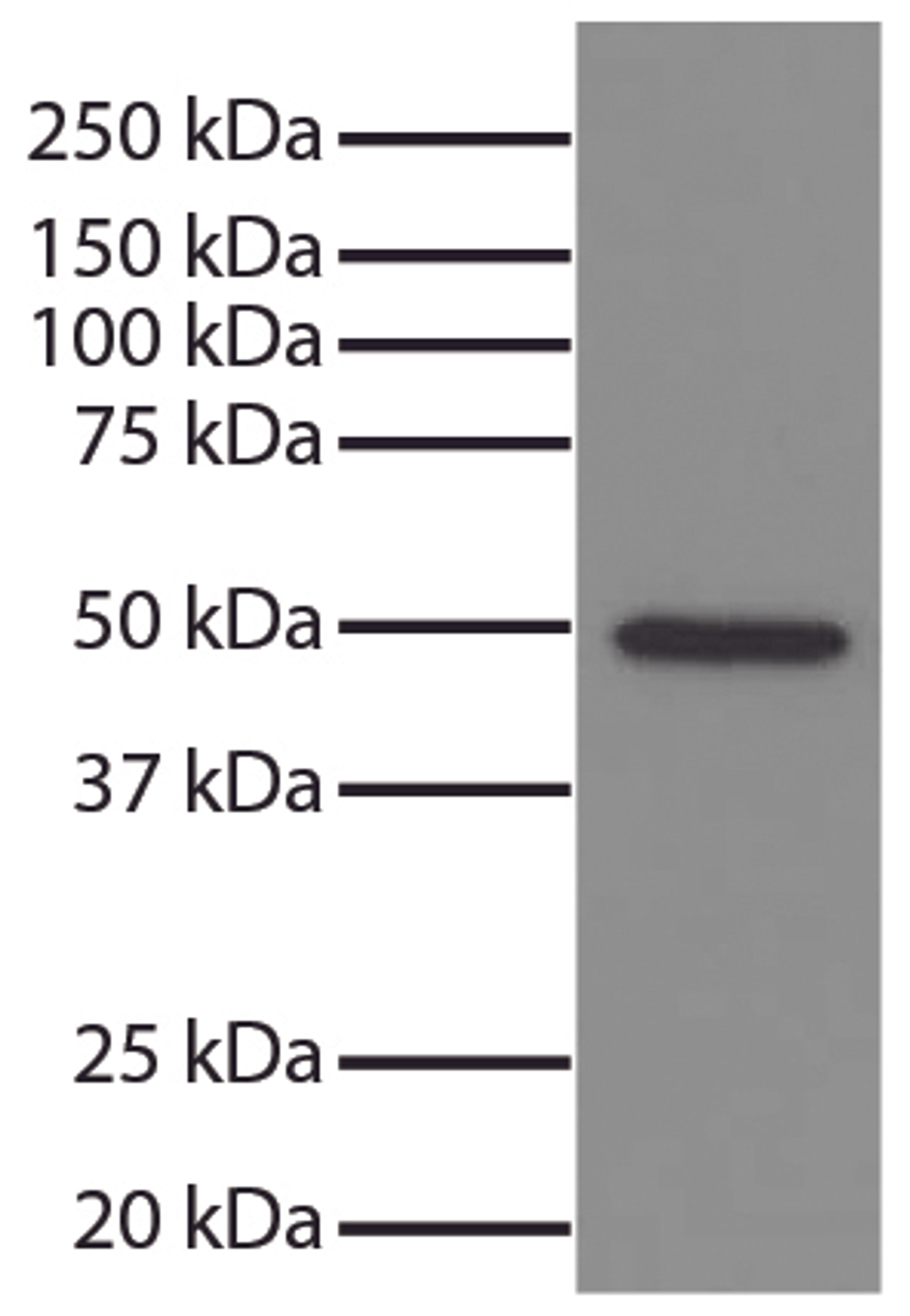 Total cell lysates from Jurkat cells were resolved by electrophoresis, transferred to PVDF membrane, and probed with Mouse Anti-GSK-3?-UNLB (Cat. No. 99-742). Proteins were visualized using Goat Anti-Mouse IgG, Human ads-HRP secondary antibody and chemilu