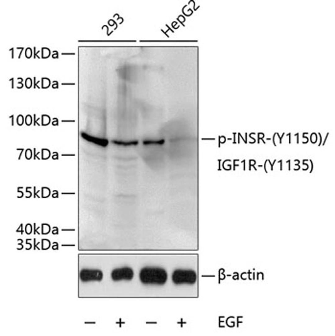 Western blot - Phospho-INSR-Y1150/IGF1R-Y1135 antibody (AP0044)