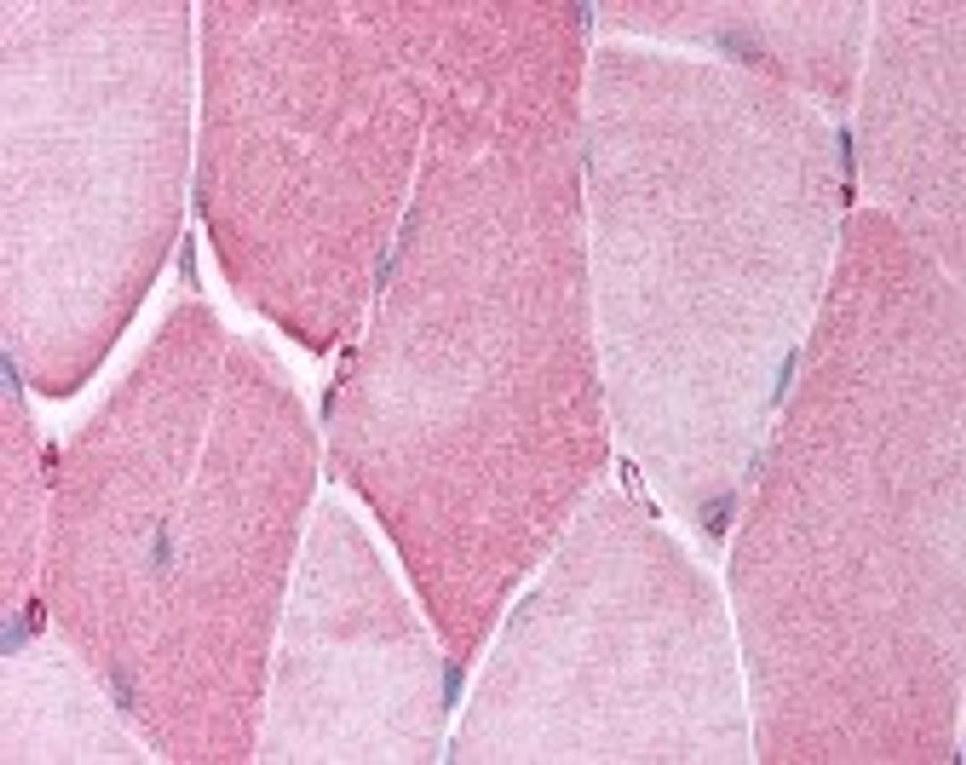 Immunohistochemistry staining of CRY2 in skeletal muscle tissue using CRY2 Antibody.