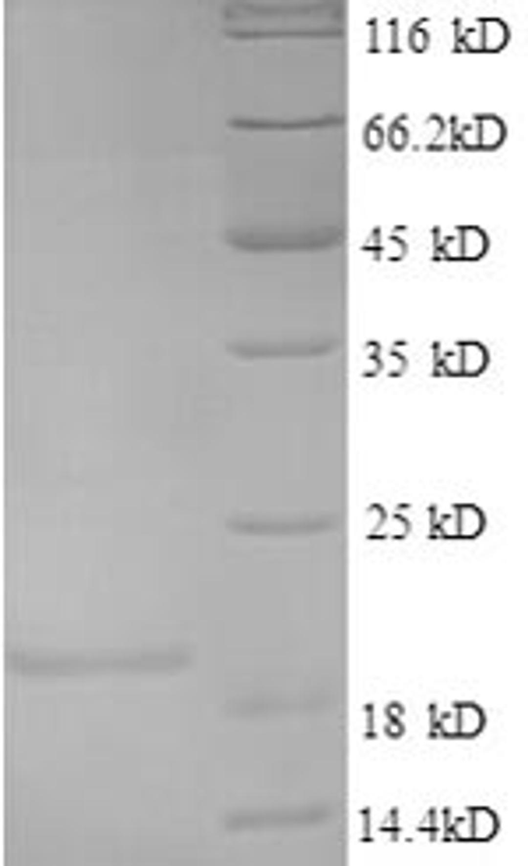 (Tris-Glycine gel) Discontinuous SDS-PAGE (reduced) with 5% enrichment gel and 15% separation gel.