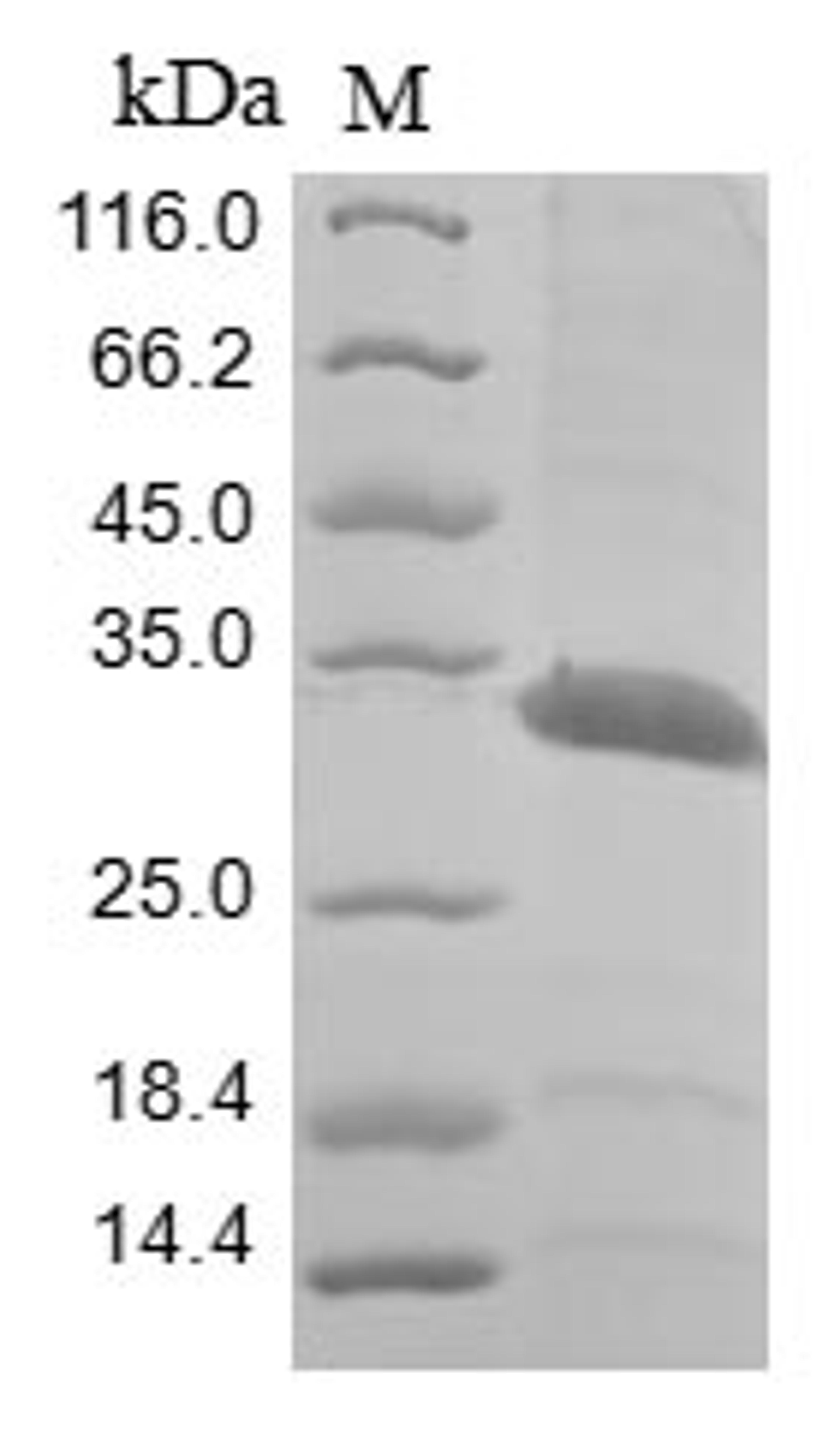 (Tris-Glycine gel) Discontinuous SDS-PAGE (reduced) with 5% enrichment gel and 15% separation gel.