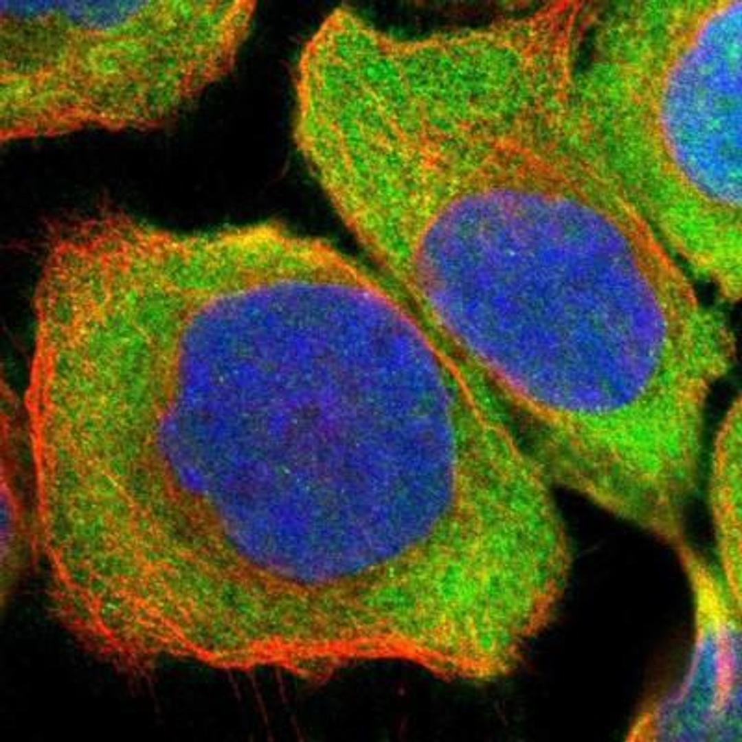 Immunocytochemistry/Immunofluorescence: SRPK1 Antibody [NBP1-87050] - Staining of human cell line A-431 shows positivity in cytoplasm.