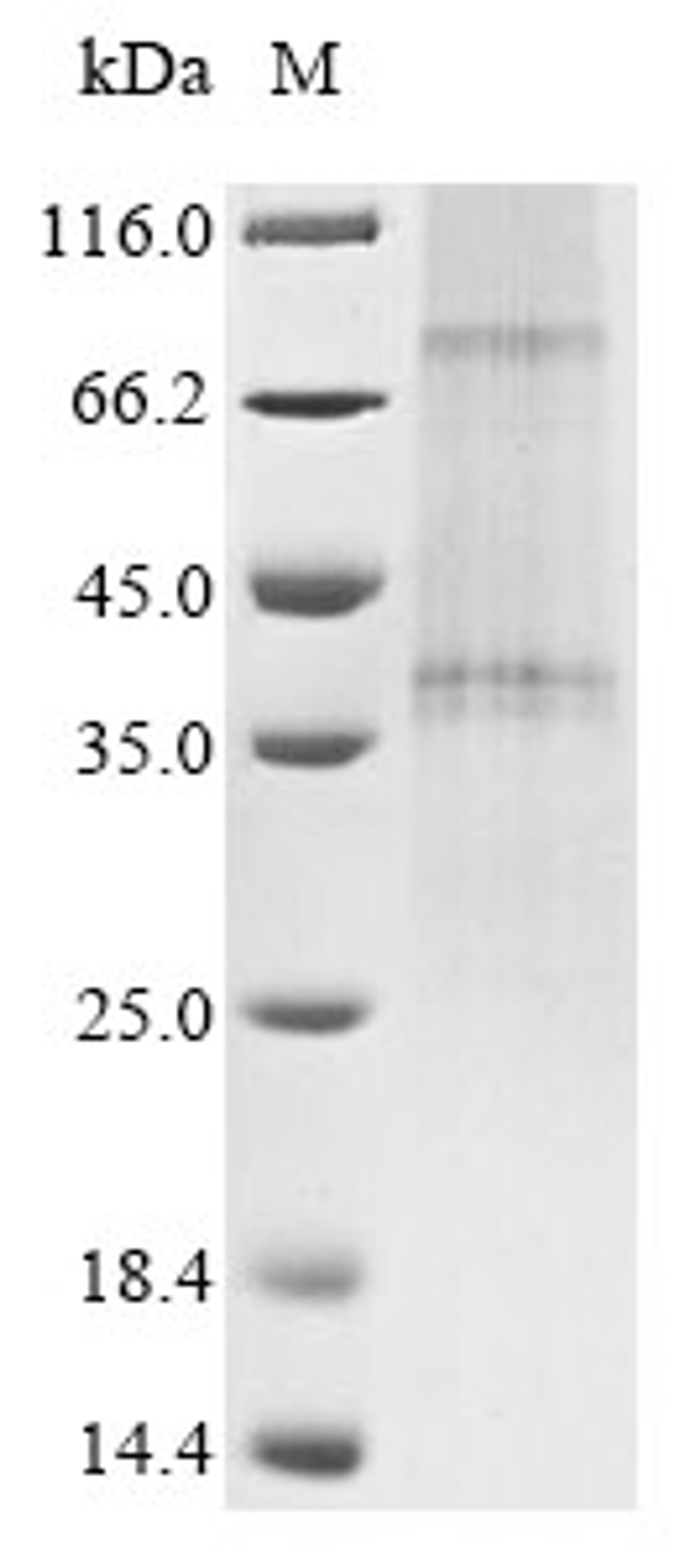 (Tris-Glycine gel) Discontinuous SDS-PAGE (reduced) with 5% enrichment gel and 15% separation gel.