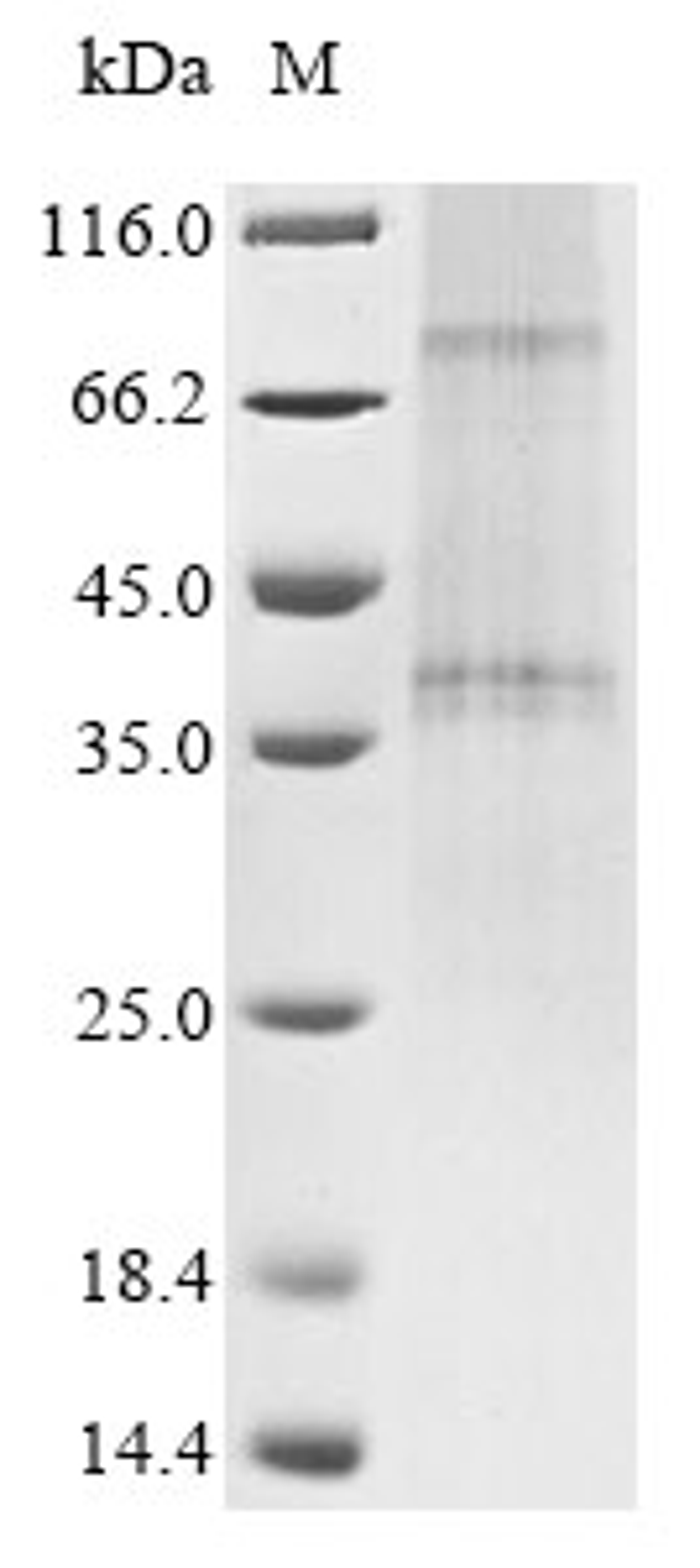 (Tris-Glycine gel) Discontinuous SDS-PAGE (reduced) with 5% enrichment gel and 15% separation gel.