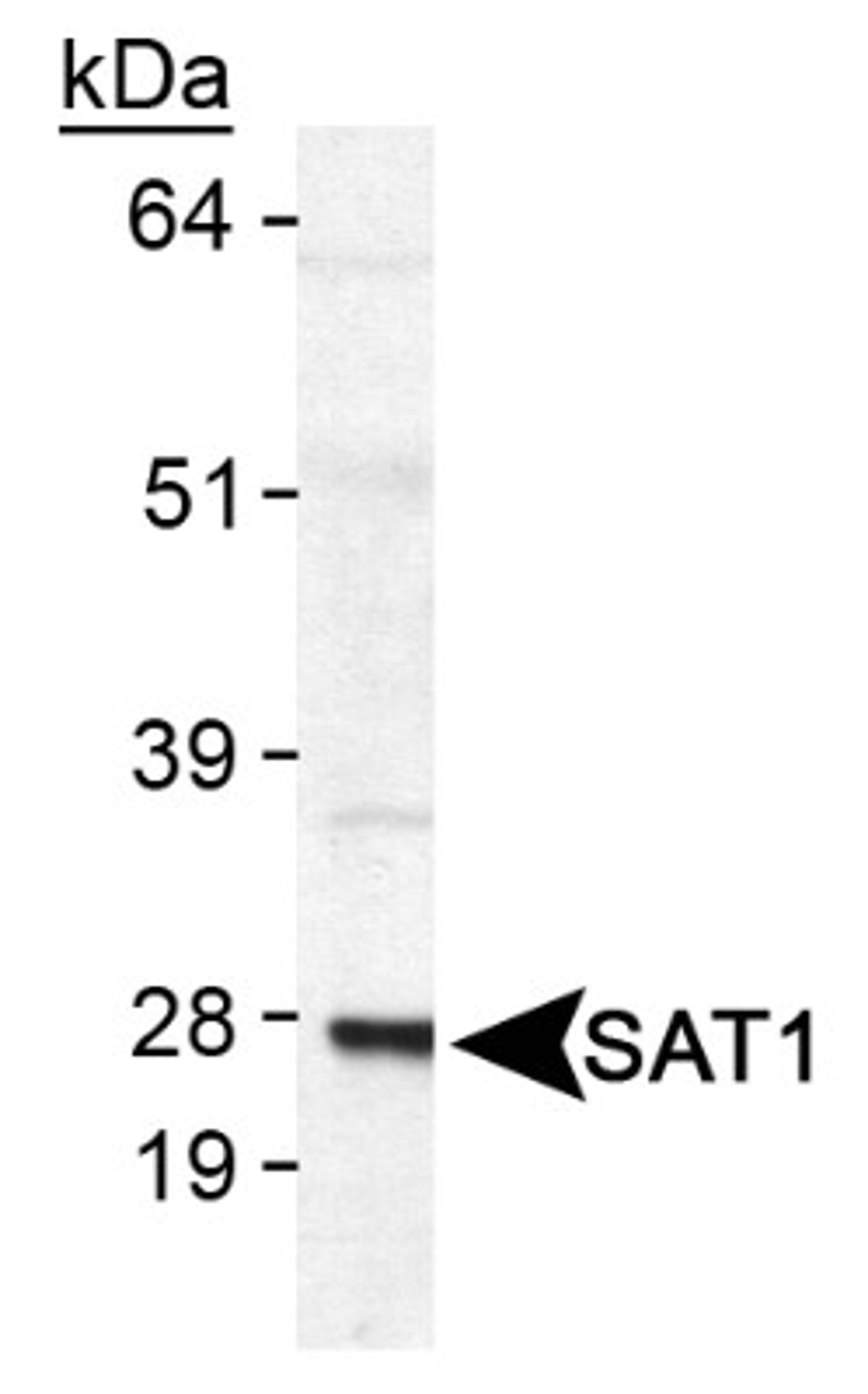 Western Blot: SAT1 Antibody [NB110-41622] - Detection of SAT1 in human SAT1 transfected lysate.