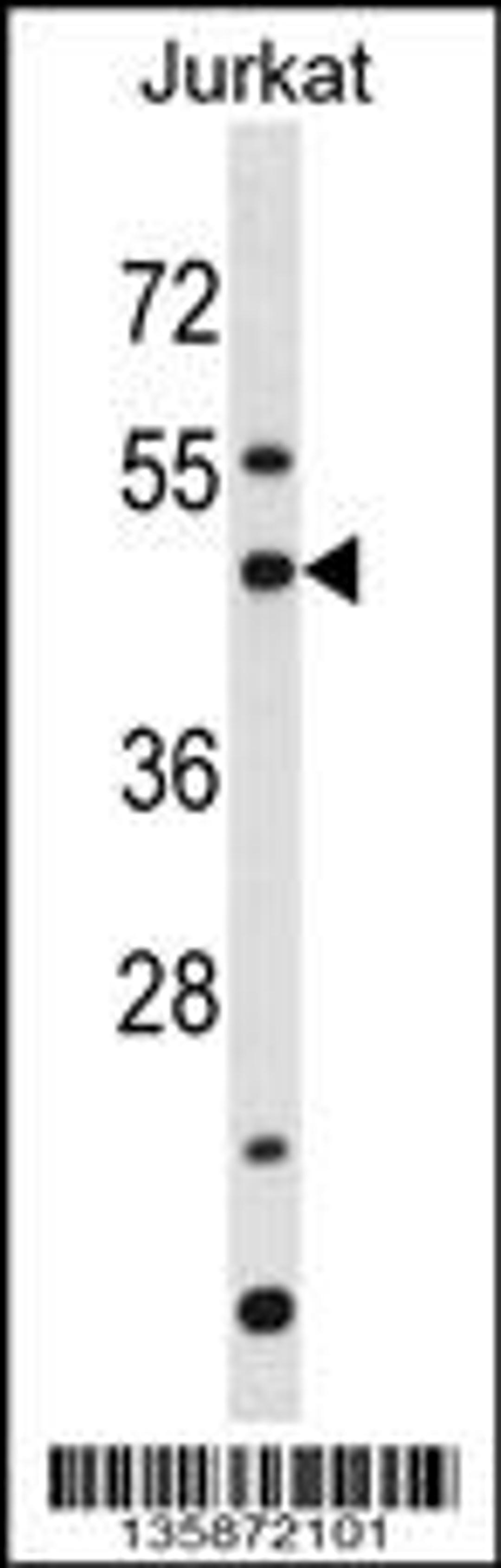 Western blot analysis in Jurkat cell line lysates (35ug/lane).