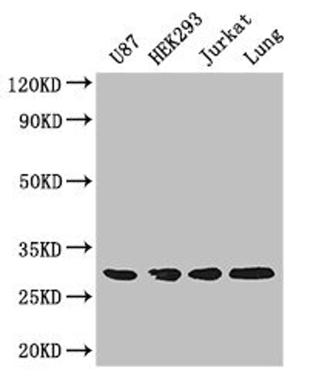 Western Blot. Positive WB detected in: U87 whole cell lysate, HEK293 whole cell lysate, Jurkat whole cell lysate, Mouse lung tissue. All lanes: LASP1 antibody at 4ug/ml. Secondary. Goat polyclonal to rabbit IgG at 1/50000 dilution. Predicted band size: 30, 37, 24 kDa. Observed band size: 30 kDa.